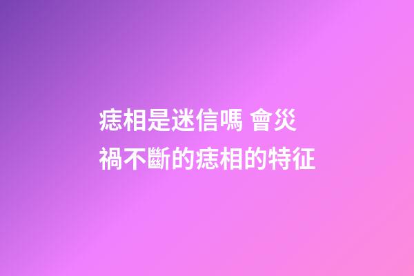 痣相是迷信嗎 會災禍不斷的痣相的特征